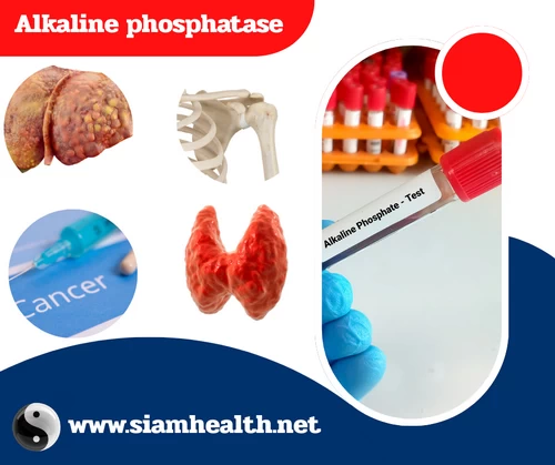 Alkaline phosphatase